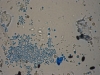 Mold picture- Airborne Aspergillus/Penicillium Spores