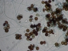 Mold picture- Arthrinium Spores