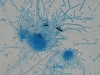 Mold picture- Aspergillus Heads Showing Spores In Chains