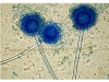 Mold picture- Aspergillus Heads