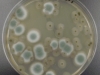 Mold picture- Colonies of Black Mold and Penicilium in Agar Media