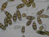 Mold picture- Curvularia Spores