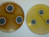 Mold picture- Colonies of Penicillium bilaii