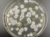 Mold picture- Penicillium Colonies
