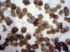 Mold picture- Fruiting bodies of Phoma species