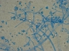 Mold picture- Trichoderma species