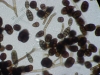 Mold picture- Ulocladium Spores