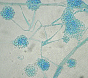 Picture of acremonium under microscope