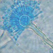 Aspergillus has been associated with health concerns