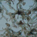 Cladosporium is a common mold that has been associated with allergies