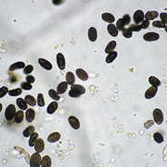 Picture of Stachybotrys Spores