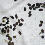 Stachybotrys spores