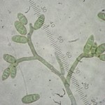 Picture of Ulocladium